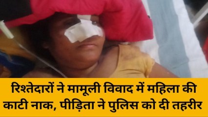 सीतापुर: मामूली विवाद रिश्तेदारों ने घर में घुसकर महिला की काटी नाक,अस्पताल में भर्ती