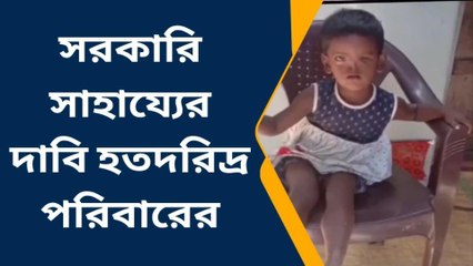 বালুরঘাট : ছোট্ট মারিয়ানার, জীবনের বড় বাঁধা শারীরিক প্রতিবন্ধকতা