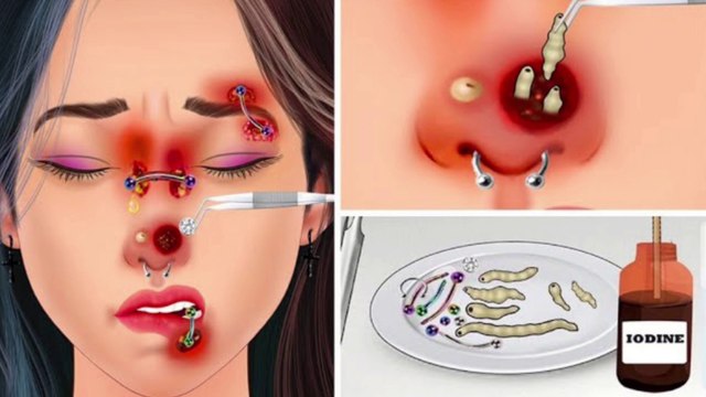 Asmr Animation | Asmr Animation Today | ASMR | D ASMRPUYA ASMR | 티눈 제거하는 방법 | 귀지 제거|귀 청소 #PUYA ASMR#귀지 제거|귀 청소#티눈 제거하는 방법#asmrvideo #asmr #asmr #asmrvideo #asmrsounds #asmrcommunity #asmrvideo #asmreating #asmrvideo #asmr #asmrsound #asmrmukbang #asmrso