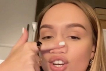 هولندية تثير ضجة على تيك توك بعدما سحقت أنفها كليا