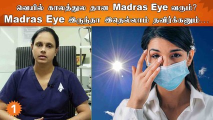 Dos & Don’t for Madras Eye | Madras Eye இருக்கவங்க கண்ண பார்த்தாலே Infection பரவுமா? | Doctors Talk
