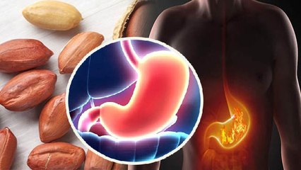 खाली पेट मूंगफली खाने से क्या होता है | खाली पेट मूंगफली खाने के नुकसान | Boldsky *health