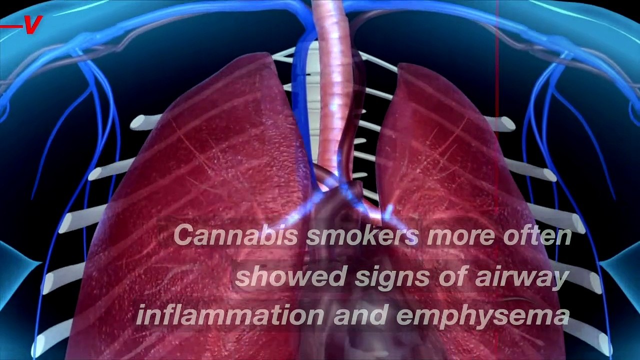 Study Finds Smoking Cannabis May Be More Damaging Than Tobacco