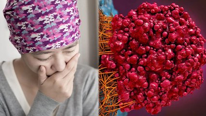 मेटास्टेटिक कैंसर क्या है ? जानिए इसके लक्षण | Metastatic Cancer Kya hai | Boldsky *Health