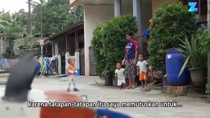 Mata Palsu untuk Anak Indonesia