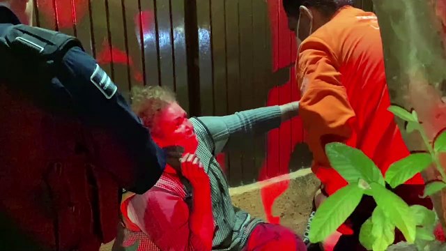 Una mujer de la tercera edad, resultó con quemaduras luego de que su vivienda se incendiara