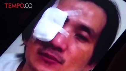 Seorang Warga di Makassar Jadi Korban Penyiraman Air Keras