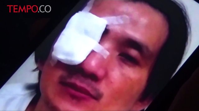 Mirip Kasus Novel, Usai Ibadah Malam, Mata Pria Ini Disiram Air Keras