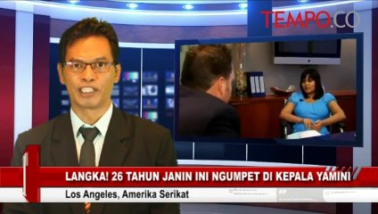 Langka-26-Tahun-Janin-Ini-Ada-di-Kepala-Yamini.flv