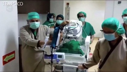 Bayi Kembar Siam di Medan Berhasil Dipisahkan