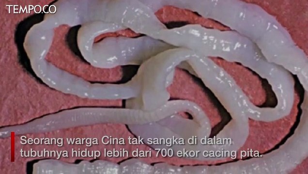Mengerikan, 700 Cacing Pita Hidup di Tubuh Usai Makan Daging Babi