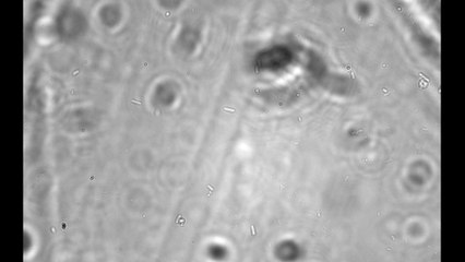 growing colonies x100