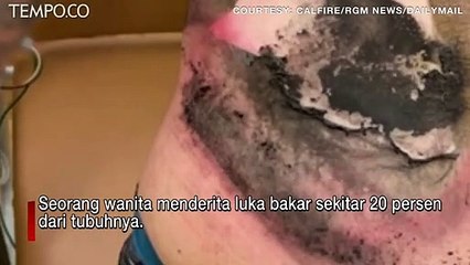Vape Pen Meledak di Tas Punggung Wanita, Akibatnya Mengerikan