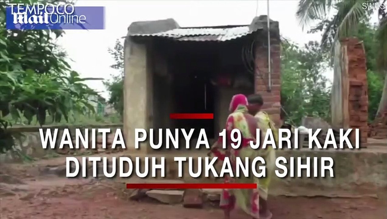 Punya 19 Jari Kaki, 12 Jari Tangan, Wanita Ini Dituduh Tukang Sihir