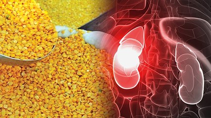 अरहर की दाल खाना इन लोगों के लिए है खतरनाक, सेहत पर पड़ता है बुरा असर | Boldsky *Health