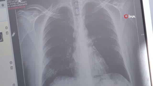 KOAH hastalarına 'sigara' uyarısı