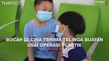 Seorang Bocah Menerima Telinga Buatan Baru Lewat Operasi Plastik di Cina
