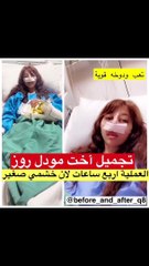 ليان عبدالله تخضع لعملية تجميل