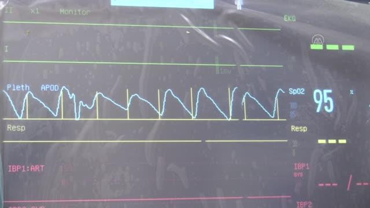 KAHRAMANMARAŞ - Hollanda'dan ambulans uçakla Türkiye'ye getirilen hastanın tedavisi sürüyor