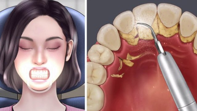 PUYA ASMR | 티눈 제거하는 방법 | 귀지 제거|귀 청소 | Asmr Personal Attention | Nail Care Routines | Treatment #asmrsleepclinic #asmrsleepclinic role-play #asmrsleepyfluffymics #asmrsleepclinicforinsomnia #asmrpersonalattention #Acne #Asmr #AsmrSleep #AsmrSpa #As