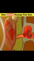 Interesting  &  Amezing Facets/आप  हमेशा  के  लिए  खो  सकते  हो  अपने  सुनने  की  शक्ति/How  Earbuds  Damage  Ears  Are  Earphone  Harmful?