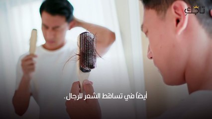 تساقط شعر الرجال