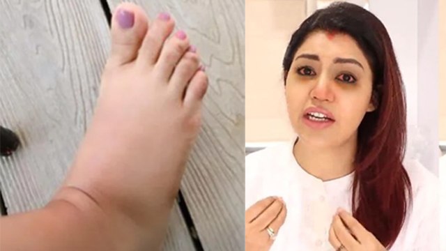 Debina Bonnerjee का Second Delivery के बाद हुआ ऐसा हाल,सूजे पैर दिखाकर बयां किया दर्द।*Entertianment