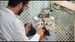 Le lenti ICL per difetti alla vista: i vantaggi rispetto al laser
