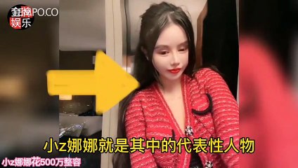 Berawal dari Bullying, Sosok Remaja Zhou Chuna, 100 Kali Operasi Plastik