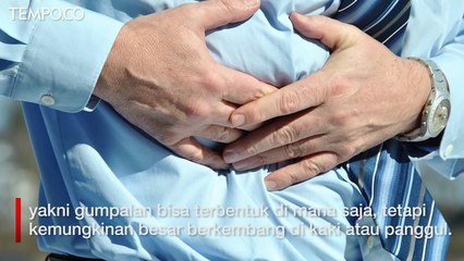 Tips Mencegah Penggumpalan Darah pada Tubuh