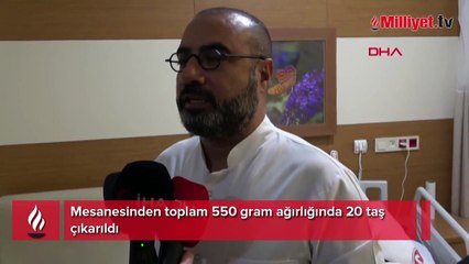 Mesanesinden toplam 550 gram ağırlığında 20 taş çıkarıldı