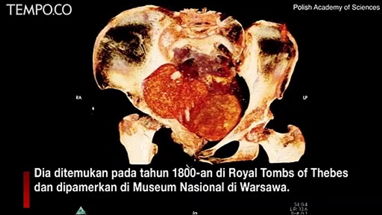 Berumur 2 Ribu Tahun, Mumi Mesir Kuno Hamil Pertama di Dunia Ditemukan di Thebes