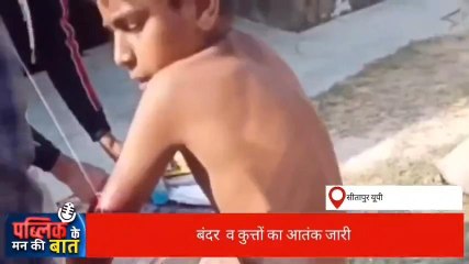 सीतापुर: कुत्तों का आतंक लगातार जारी, सुनिए लोगों की राय