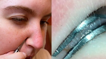 Blackhead tweezers under the microscope