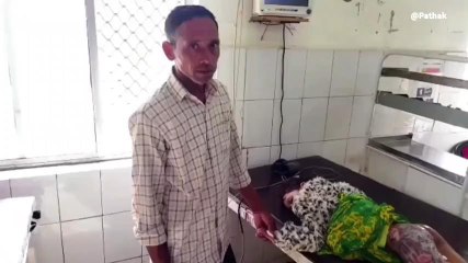 बदायूं: खेलते-खेलते खौलते पानी में जा गिरी दो बच्चियां, दोनों मासूम बुरी तरह झुलसी