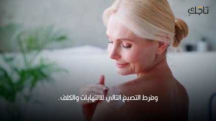 حمض المنديك