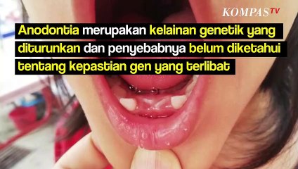 Kenali Anodontia, Jenis Kelainan yang Menyebabkan Gigi Tak Bisa Tumbuh hingga Dewasa