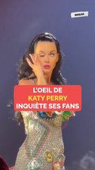 L'oeil de Katy Perry inquiète ses fans