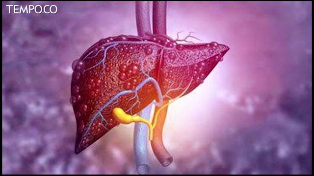 Orang Tua Diminta Waspadai Gejala Awal Anak Terserang Hepatitis Akut Misterius