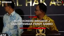 Komnas HAM Perlihatkan Foto Kondisi Brigadir J Usai Ditembak Ferdy Sambo