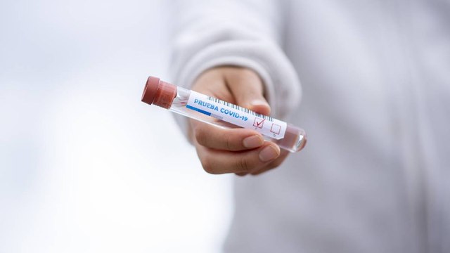 Incrementa en un 17% las pruebas positivas de Covid