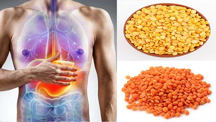 दाल खाने से नहीं बनती है गैस, इस दाल को खाने से नहीं बनती है गैस | Boldsky *Health