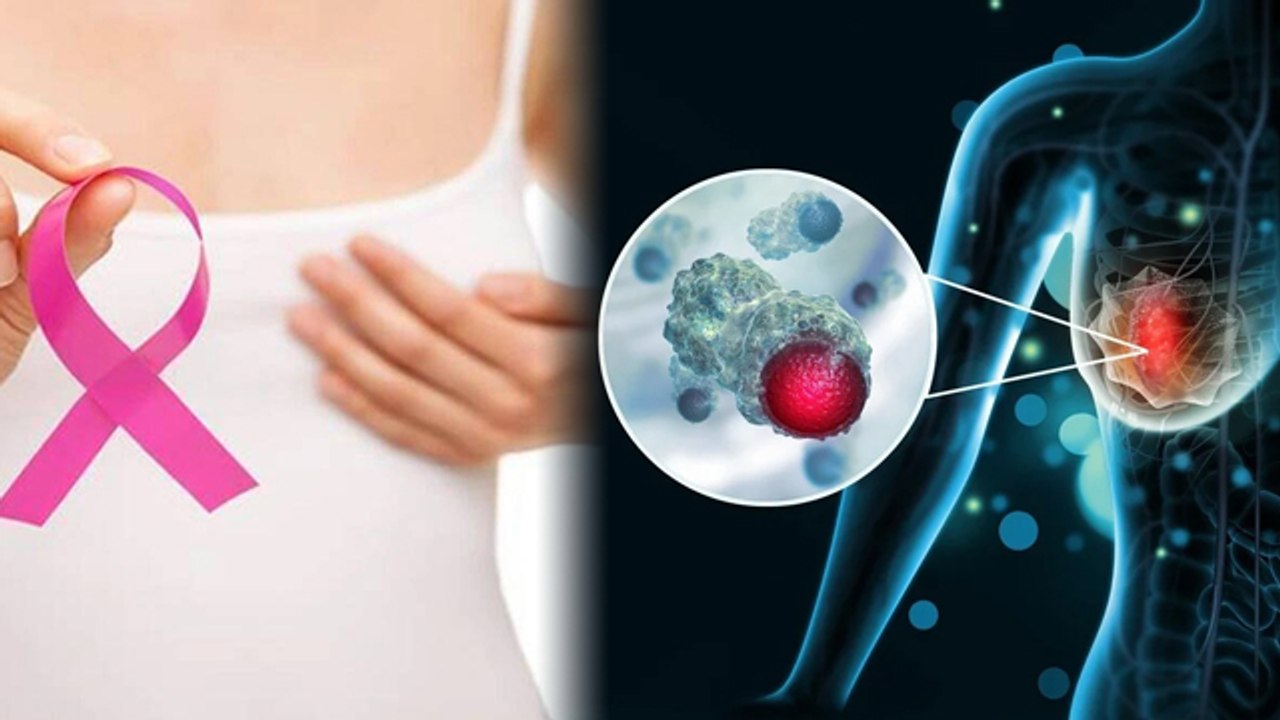 Breast में होने वाली हर गांठ क्या होती है Cancer | Breast Cancer Symptoms | Boldsky *Health