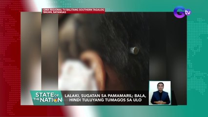 Lalaki, sugatan sa pamamaril; bala, hindi tuluyang tumagos sa ulo | SONA
