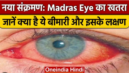 Madras Eye : Tamil Nadu में तेजी से फैल रहा संक्रमण, जानिए वजह ! | वनइंडिया हिंदी |*News