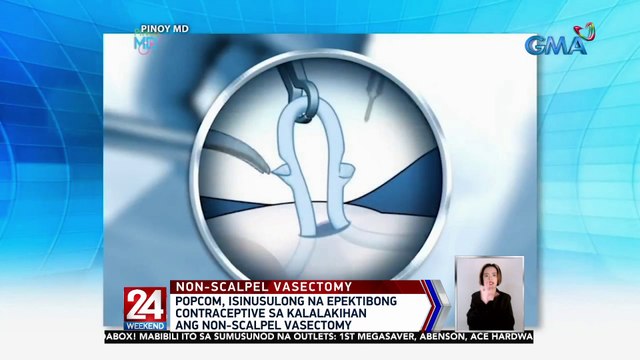PopCom, isinusulong na epektibong contraceptive sa kalalakihan ang non-scalpel vasectomy | 24 Oras Weekend
