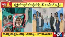 Doctors Remove 187 Coins From Stomach Of 58 Year-Old-Man In Raichur | Public TV