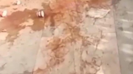 श्योपुर: वेतन नहीं मिलने से सफाई कर्मियों की हड़ताल:अस्पताल में पसरी गंदगी, देखिए खास तस्वीरें