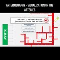 Arteriography - visualization of the arteries