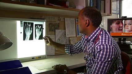 New report predicts more than five million people could be dealing with arthritis by 2030